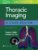 Thoracic Imaging: A Core Review – ISBN-10: 197512622X